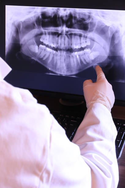 Best Emergency Dental Care for Broken or Chipped Teeth in Mulberry, IN
