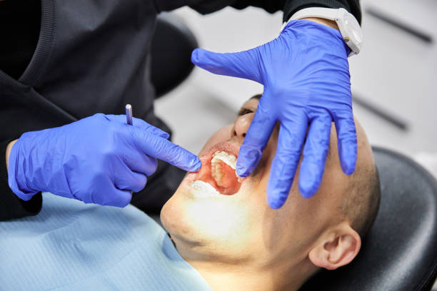 Best Emergency Tooth Extraction in Mulberry, IN